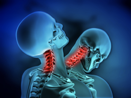 Whiplash injury to the neck